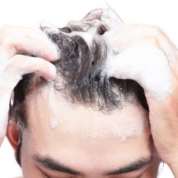 Nizoral 1% Anti Dandruff Treatment 100ml